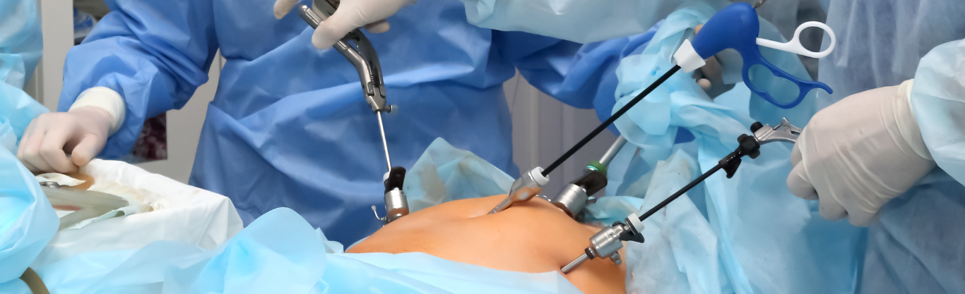 I vantaggi della laparoscopia per le patologie coliche e proctologiche