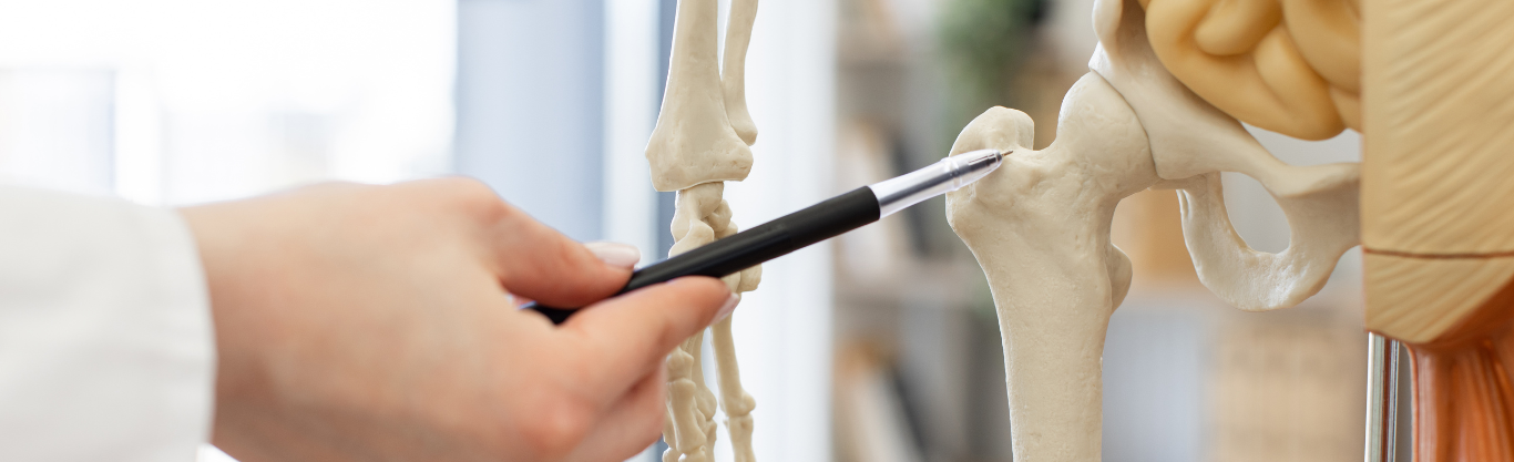 Quando è necessario fare la protesi all’anca?