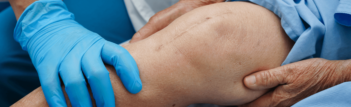 Quando è necessaria una protesi al ginocchio?