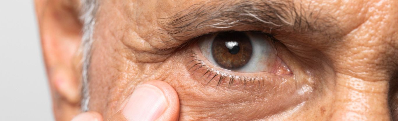 Come funziona l’intervento con il laser micropulsato?